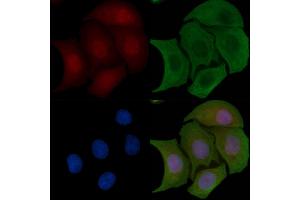 ABIN6255378 and ABIN6267700 staining Hela cells by IF/ICC. (HDAC5 抗体  (pSer498))