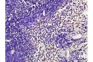 Immunohistochemistry (Paraffin-embedded Sections) (IHC (p)) image for anti-CD19 Molecule (CD19) (pTyr531) antibody (ABIN683623)