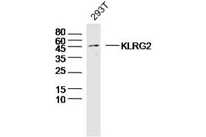 293T lysates probed with KLRG2 Polyclonal Antibody, Unconjugated  at 1:300 dilution and 4˚C overnight incubation. (KLRG2 抗体  (AA 101-200))