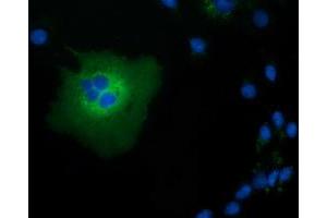 Anti-TCP11L2 mouse monoclonal antibody (ABIN2453717) immunofluorescent staining of COS7 cells transiently transfected by pCMV6-ENTRY TCP11L2 (RC207129). (TCP11L2 抗体)