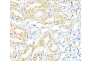 Immunohistochemistry of paraffin-embedded Mouse kidney using BAX Polyclonal Antibody at dilution of 1:100 (40x lens). (BAX 抗体)