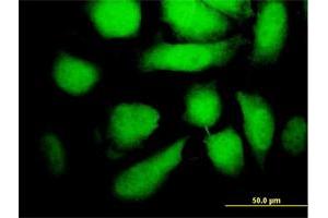 Immunofluorescence of monoclonal antibody to MAP2K5 on HeLa cell. (MAP2K5 抗体  (AA 1-120))