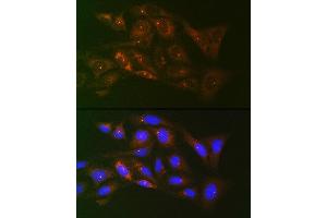 Immunofluorescence (IF) image for anti-Tubulin, gamma 1 (TUBG1) antibody (ABIN7271052)