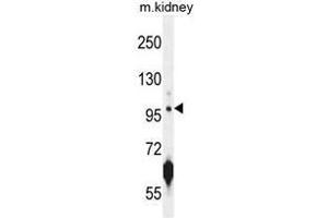 ATPGD1 Antibody (N-term) western blot analysis in mouse kidney tissue lysates (35µg/lane).