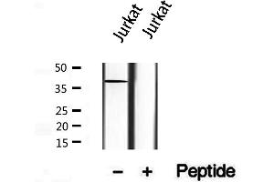 Western blot analysis of extracts from Jurkat, using Syntaxin 16 antibody. (Syntaxin 16 抗体  (N-Term))