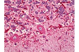 Anti-KDEL Receptor antibody IHC of human brain, cerebellum. (KDELR 抗体)
