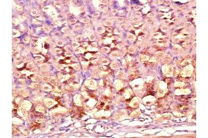 Immunohistochemistry (Paraffin-embedded Sections) (IHC (p)) image for anti-Deiodinase, Iodothyronine, Type II (DIO2) (AA 101-200) antibody (ABIN702460)