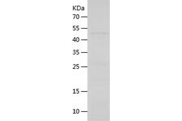 Cyclin G1 Protein (CCNG1) (AA 1-295) (His-IF2DI Tag)