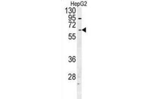 Western Blotting (WB) image for anti-UDP Glucuronosyltransferase 1 Family, Polypeptide A1 (UGT1A1) antibody (ABIN2997636) (UGT1A1 抗体)
