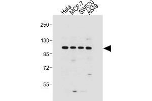 All lanes : Anti-G Antibody (N-term) at 1:1000 dilution Lane 1: Hela whole cell lysate Lane 2: MCF-7 whole cell lysate Lane 3: S whole cell lysate Lane 4: A549 whole cell lysate Lysates/proteins at 20 μg per lane. (GAA 抗体  (N-Term))