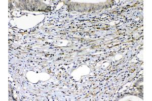 IHC analysis of VEGF Receptor 2  using anti-VEGF Receptor 2  antibody . (VEGFR2/CD309 抗体  (AA 20-242))