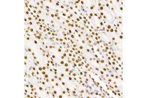 Immunohistochemistry (IHC) image for anti-Signal Transducer and Activator of Transcription 3 (Acute-Phase Response Factor) (STAT3) (pTyr705) antibody (ABIN6136266)