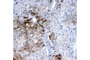 IHC analysis of GSTA1/A2/A3/A4/A5 using anti-GSTA1/A2/A3/A4/A5 antibody (ABIN5518995). (GSTA1 抗体  (AA 2-222))