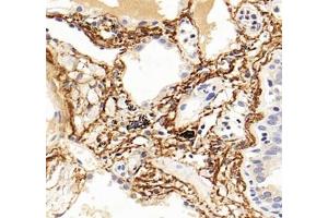 Immunohistochemistry analysis of paraffin-embedded human lung using,MFAP4 (ABIN7074614) at dilution of 1: 2000 (MFAP4 抗体)