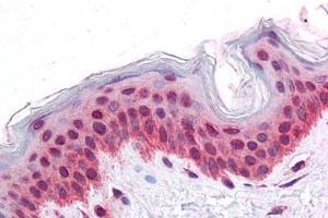 Immunohistochemistry (Formalin-fixed Paraffin-embedded Sections) (IHC (fp)) image for anti-Selenoprotein N, 1 (SEPN1) (C-Term) antibody (ABIN6745740)