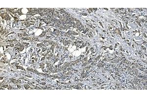 IHC analysis of PNPT1 using anti-PNPT1 antibody (ABIN7599172).