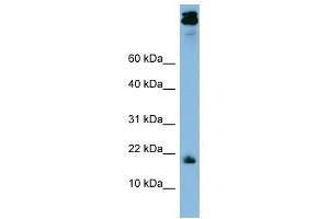 ASAH1 antibody used at 1 ug/ml to detect target protein. (ASAH1 抗体)
