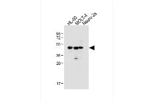 All lanes : Anti-BLMH Antibody (Center) at 1:1000 dilution Lane 1: HL-60 whole cell lysate Lane 2: MOLT-4 whole cell lysate Lane 3: Neuro-2a whole cell lysate Lysates/proteins at 20 μg per lane. (BLMH 抗体  (AA 212-242))