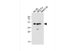 All lanes : Anti-BLMH Antibody (Center) at 1:1000 dilution Lane 1: HL-60 whole cell lysate Lane 2: MOLT-4 whole cell lysate Lane 3: Neuro-2a whole cell lysate Lysates/proteins at 20 μg per lane. (BLMH 抗体  (AA 212-242))