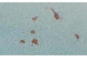 Immunohistochemical staining using MAb-Ad-H-2 antibody on Adenovirus AV2 infected Hela cells (Human Adenovirus Hexon (HAdV Hexon) 抗体)