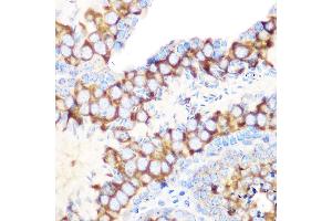 Immunohistochemistry of paraffin-embedded mouse testis using RUVBL1/TIP49A/PONTIN Rabbit mAb (ABIN7270118) at dilution of 1:100 (40x lens). (RUVBL1 抗体)