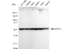 Western blotting analysis using PTBP1 antibody (ABIN7799882).