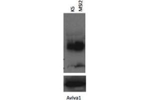MSI2 antibody - N-terminal region  validated by WB using K562 cells lysate at 1:1000. (MSI2 抗体  (N-Term))