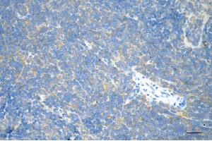 Immunohistochemistry was performed on paraffin-embedded mouse spleen using RHOA antibody (ABIN7800142), 1:200).
