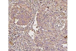 IHC analysis of IRS1 using anti-IRS1 antibody (ABIN7599659).