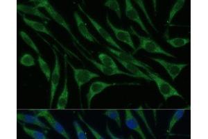 Immunofluorescence (IF) image for anti-Valyl-tRNA Synthetase (VARS) antibody (ABIN7260984)