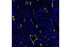 Immunofluorescence (IF) image for anti-Cadherin 5 (CDH5) (AA 48-599) antibody (ABIN7455190)