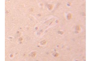 Used in DAB staining on fromalin fixed paraffin-embedded Heart tissue (PHPT1 抗体  (AA 1-125))