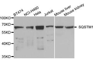 Western blot analysis of extracts of various cell lines, using SQSTM1 antibody (ABIN5975634) at 1/1000 dilution. (SQSTM1 抗体)