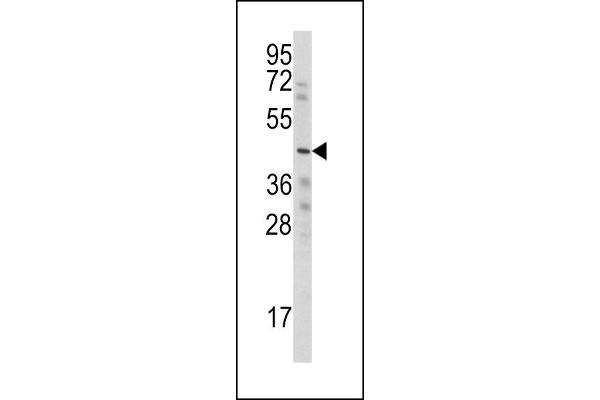 WISP3 抗体  (AA 305-335)