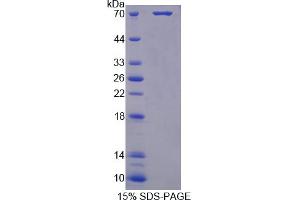 Image no. 1 for Pepsinogen C (PGC) (AA 17-392) protein (His tag,GST tag) (ABIN6236610) (PGC Protein (AA 17-392) (His tag,GST tag))