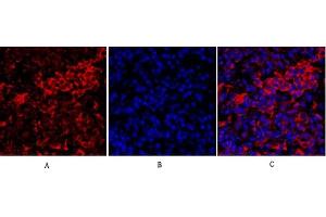 Immunofluorescence analysis of mouse lung tissue. (IRS1 抗体)