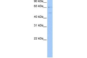 WB Suggested Anti-WASF3 Antibody Titration: 0. (WASF3 抗体  (N-Term))