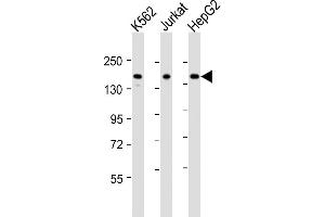 All lanes : Anti-IQSEC2 Antibody (Center) at 1:2000 dilution Lane 1: K562 whole cell lysates Lane 2: Jurkat whole cell lysates Lane 3: HepG2 whole cell lysates Lysates/proteins at 20 μg per lane. (IQSEC2 抗体  (AA 451-484))