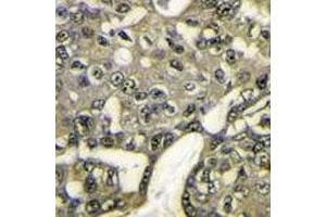 Immunohistochemistry (IHC) image for anti-V-Akt Murine Thymoma Viral Oncogene Homolog 1 (AKT1) (AA 115-144) antibody (ABIN3029459)