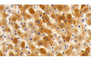 Immunohistochemistry (IHC) image for anti-Orosomucoid 2 (ORM2) antibody (ABIN7442267)