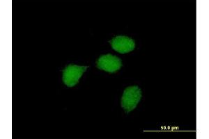 Immunofluorescence of purified MaxPab antibody to BCL3 on HeLa cell. (BCL3 抗体  (AA 1-446))