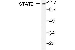 Image no. 1 for anti-Signal Transducer and Activator of Transcription 2, 113kDa (STAT2) antibody (ABIN271825) (STAT2 抗体)