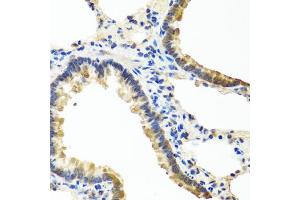 Immunohistochemistry of paraffin-embedded rat lung using ANGPT1 antibody (ABIN5974767) at dilution of 1/100 (40x lens). (Angiopoietin 1 抗体)