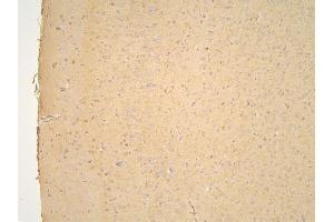 IHC analysis of PPA1 using anti-PPA1 antibody (ABIN6719527). (Pyrophosphatase (Inorganic) 1 (PPA1) (AA 7-236) 抗体)