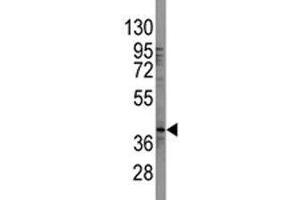 Western Blotting (WB) image for anti-SRY (Sex Determining Region Y)-Box 2 (SOX2) (AA 89-119) antibody (ABIN3032736)