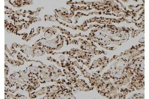 Immunohistochemistry (IHC) image for anti-OTU Domain, Ubiquitin Aldehyde Binding 1 (OTUB1) (Internal Region) antibody (ABIN6263916)