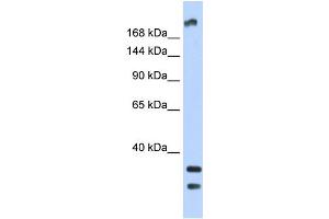 Western Blotting (WB) image for anti-Transient Receptor Potential Cation Channel, Subfamily M, Member 2 (TRPM2) (N-Term) antibody (ABIN2781840)