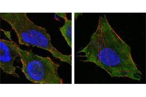 Confocal immunofluorescence analysis of Hela (left) and L-02 (right) cells using S100A10/P11 mouse mAb(green). (S100A10 抗体)
