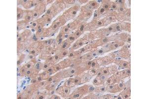 IHC-P analysis of Human Tissue, with DAB staining. (PTMA 抗体  (AA 2-111))
