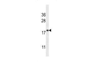 T Antibody (C-term) (ABIN656935 and ABIN2846127) western blot analysis in HL-60 cell line lysates (35 μg/lane). (Transmembrane Protein 70 (TMM70) (AA 231-260), (C-Term) 抗体)